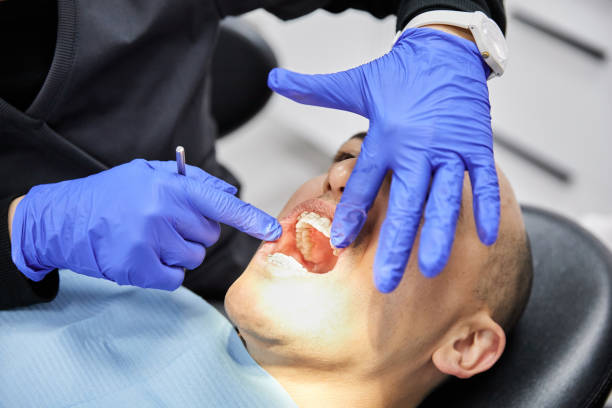 Best Emergency Wisdom Teeth Removal in Montebello, CA