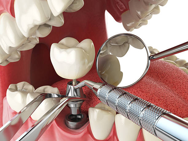 Best Emergency Dental Care for Trauma or Injury in Montebello, CA